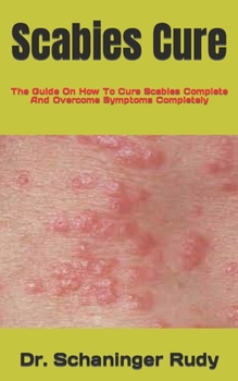Paperback Scabies Cure: The Guide On How To Cure Scabies Complete And Overcome Symptoms Completely Book