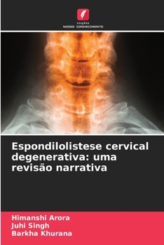 Spondylolisthésis cervical dégénératif : une revue narrative (French Edition)