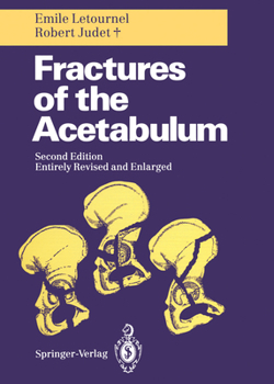 Paperback Fractures of the Acetabulum Book