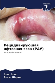 Paperback Рецидивирующая афтозна&# [Russian] Book