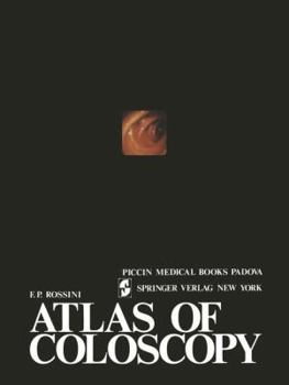 Paperback Atlas of Coloscopy Book