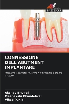 Paperback Connessione Dell'abutment Implantare [Italian] Book