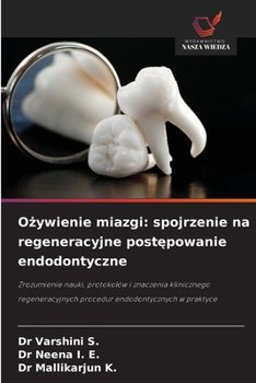 Ozywienie miazgi: spojrzenie na regeneracyjne postepowanie endodontyczne (Polish Edition)