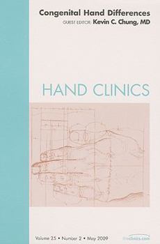Hardcover Congenital Hand Differences, an Issue of Hand Clinics: Volume 25-2 Book