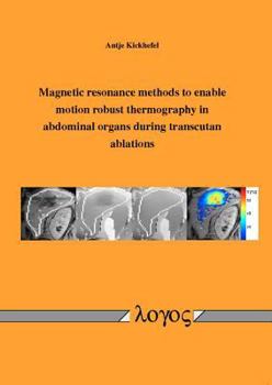 Paperback Magnetic Resonance Methods to Enable Motion Robust Thermography in Abdominal Organs During Transcutan Ablations Book