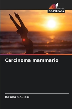 Paperback Carcinoma mammario [Italian] Book