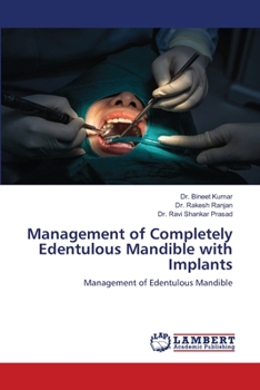 Management of Completely Edentulous Mandible with Implants: Management of Edentulous Mandible