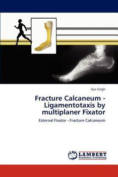 Paperback Fracture Calcaneum - Ligamentotaxis by multiplaner Fixator Book