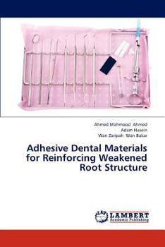 Paperback Adhesive Dental Materials for Reinforcing Weakened Root Structure Book
