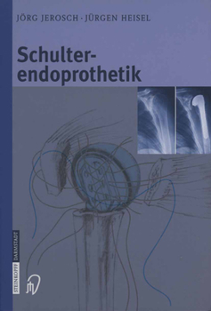 Hardcover Schulterendoprothetik: Indikation, Implantate, Op-Technik, Nachbehandlung, Begutachtung [German] Book