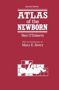 Paperback Atlas of the Newborn Book