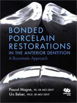 Hardcover Bonded Porcelain Restorations in the Anterior Dentition: A Biomimetic Approach Book