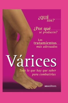 Paperback Várices: todo lo que hay que saber para combatirlas [Spanish] Book