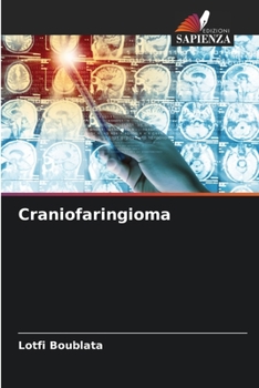 Paperback Craniofaringioma [Italian] Book