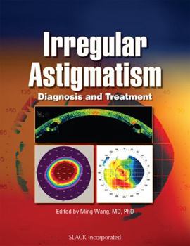 Paperback Irregular Astigmatism: Diagnosis and Treatment Book