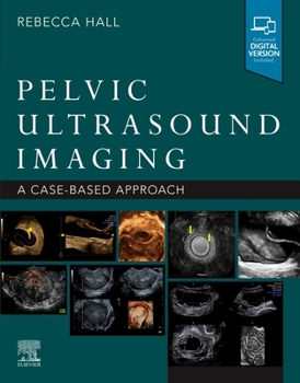 Paperback Pelvic Ultrasound Imaging: A Cased-Based Approach Book