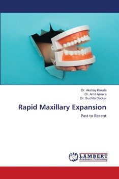 Paperback Rapid Maxillary Expansion Book