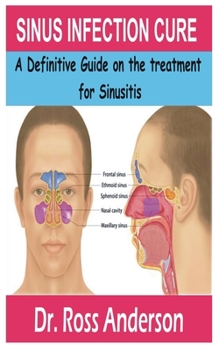 Paperback Sinus Infection Cure: A Definitive Guide on the treatment for Sinusitis Book