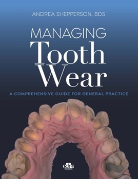 Hardcover Managing Tooth Wear (C) / Shepperson Book