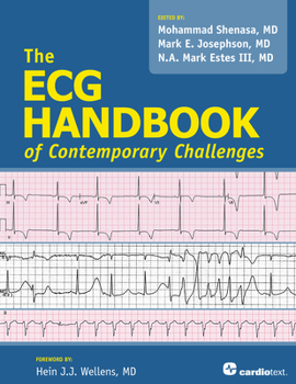 Paperback ECG Handbook of Contemporary Challenges Book