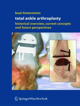 Hardcover Total Ankle Arthroplasty: Historical Overview, Current Concepts and Future Perspectives Book