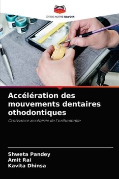 Paperback Accélération des mouvements dentaires othodontiques [French] Book