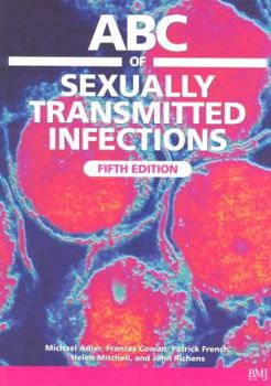 Paperback ABC of Sexually Transmitted Infections Book