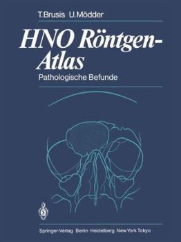 Paperback Hno Röntgen-Atlas: Pathologische Befunde [German] Book