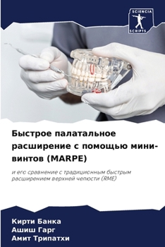 Paperback Быстрое палатальное рас& [Russian] Book