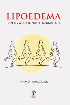 Paperback Lipoedema: An Evolutionary Mismatch Book