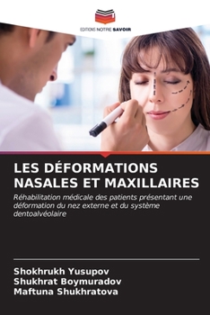 Paperback Les Déformations Nasales Et Maxillaires [French] Book