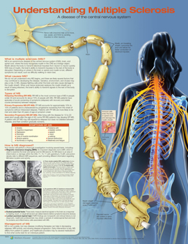 Wall Chart Understanding Multiple Sclerosis Anatomical Chart Book