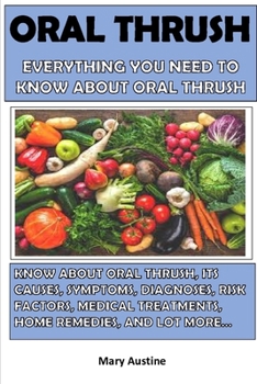 Paperback Oral Thrush: Everything You Need To Know About Oral Thrush Book