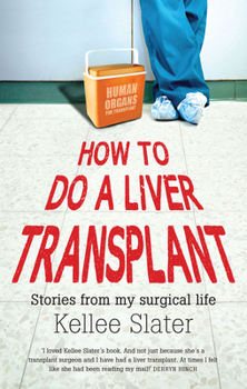 Paperback How to Do a Liver Transplant: Stories from My Surgical Life Book