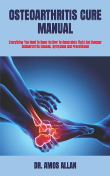 Paperback Osteoarthritis Cure Manual: Everything You Need To Know On How To Completely Fight And Conquer Osteoarthritis (Causes, Symptoms And Preventions) Book