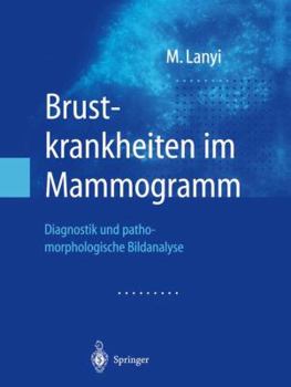 Paperback Brustkrankheiten Im Mammogramm: Diagnostik Und Pathomorphologische Bildanalyse [German] Book