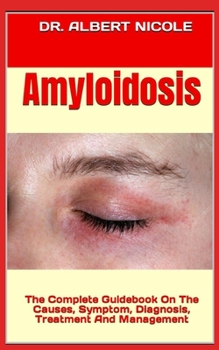 Amyloidosis: The Complete Guidebook On The Causes, Symptom, Diagnosis, Treatment And Management