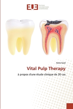 Paperback Vital Pulp Therapy [French] Book