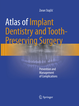 Paperback Atlas of Implant Dentistry and Tooth-Preserving Surgery: Prevention and Management of Complications Book