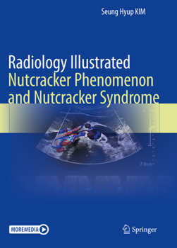 Paperback Radiology Illustrated: Nutcracker Phenomenon and Nutcracker Syndrome Book