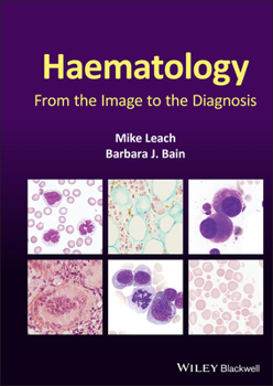 Hardcover Haematology: From the Image to the Diagnosis Book