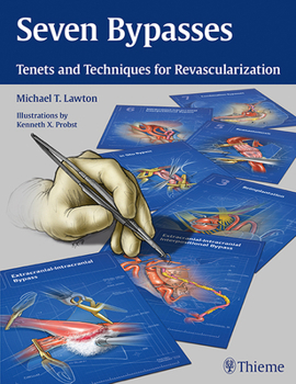 Hardcover Seven Bypasses: Tenets and Techniques for Revascularization Book