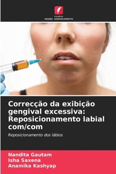Paperback Correcção da exibição gengival excessiva: Reposicionamento labial com/com [Portuguese] Book