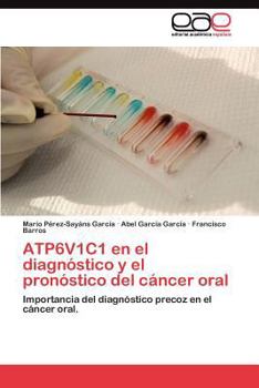 Atp6v1c1 En El Diagnostico y El Pronostico del Cancer Oral
