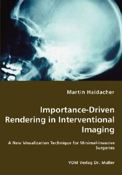 Paperback Importance-Driven Rendering in Interventional Imaging - A New Visualization Technique for Minimal-Invasive Surgeries Book
