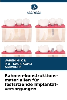 Paperback Rahmen-konstruktions-materialien für festsitzende Implantat-versorgungen [German] Book