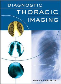 Hardcover Diagnostic Thoracic Imaging Book
