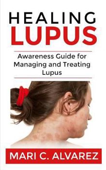 Paperback Healing Lupus: Awareness Guide for Managing and Treating Lupus Book