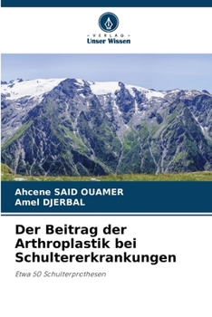 Der Beitrag der Arthroplastik bei Schultererkrankungen: Etwa 50 Schulterprothesen (German Edition)