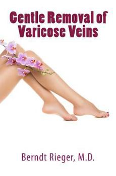 Paperback Gentle Removal of Varicose Veins Book